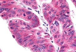 Invitrogen CCR11 Polyclonal Antibody 50 &mu;g; Unconjugated:Antibodies,