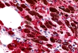 Invitrogen CCR11 Polyclonal Antibody 50 &mu;g; Unconjugated:Antibodies,