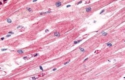 Invitrogen CCR11 Polyclonal Antibody 50 &mu;g; Unconjugated:Antibodies,