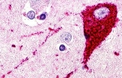 Invitrogen CCR11 Polyclonal Antibody 50 &mu;g; Unconjugated:Antibodies,