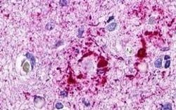 Invitrogen CCR11 Polyclonal Antibody 50 &mu;g; Unconjugated:Antibodies,
