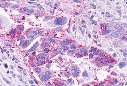 Invitrogen CCRL2 Polyclonal Antibody 50 &mu;g; Unconjugated:Antibodies,