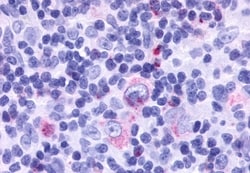 Invitrogen CCRL2 Polyclonal Antibody 50 &mu;g; Unconjugated:Antibodies,