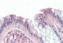 Invitrogen CD97 Polyclonal Antibody 50 &mu;g; Unconjugated:Antibodies,