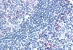 Invitrogen CELSR1 Polyclonal Antibody 50 &mu;g; Unconjugated:Antibodies,