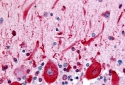 Invitrogen CELSR3 Polyclonal Antibody 50 &mu;g; Unconjugated:Antibodies,
