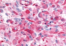 Invitrogen CHRM2 Polyclonal Antibody 50 &mu;g; Unconjugated:Antibodies,