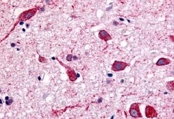 Invitrogen CHRM2 Polyclonal Antibody 50 &mu;g; Unconjugated:Antibodies,