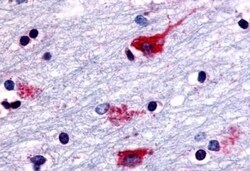 Invitrogen CHRM2 Polyclonal Antibody 50 μg; Unconjugated:Antibodies,