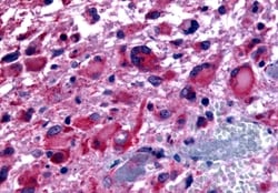 Invitrogen CHRM2 Polyclonal Antibody 50 μg; Unconjugated:Antibodies,