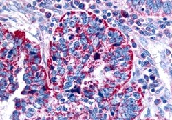 Invitrogen CHRM2 Polyclonal Antibody 50 μg; Unconjugated:Antibodies,