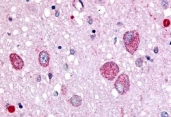 Invitrogen CHRM2 Polyclonal Antibody 50 μg; Unconjugated:Antibodies,
