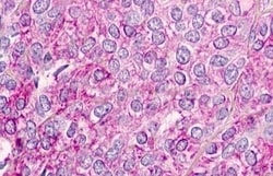 Invitrogen CMKLR1 Polyclonal Antibody 50 &mu;g; Unconjugated:Antibodies,