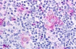 Invitrogen CMKLR1 Polyclonal Antibody 50 &mu;g; Unconjugated:Antibodies,