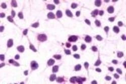 Invitrogen Cannabinoid Receptor 1 Polyclonal Antibody 50 &mu;g; Unconjugated:Anticorps,