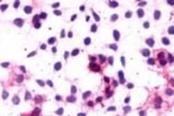 Invitrogen Cannabinoid Receptor 1 Polyclonal Antibody 50 &mu;g; Unconjugated:Anticorps,