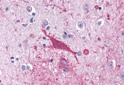 Invitrogen Cannabinoid Receptor 1 Polyclonal Antibody 50 &mu;g; Unconjugated:Anticorps,