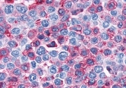 Invitrogen Cannabinoid Receptor 1 Polyclonal Antibody 50 &mu;g; Unconjugated:Anticorps,