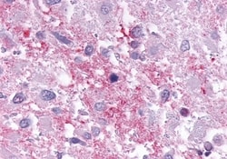 Invitrogen Cannabinoid Receptor 1 Polyclonal Antibody 50 &mu;g; Unconjugated:Anticorps,