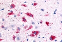 Invitrogen CRHR1 Polyclonal Antibody 50 μg; Unconjugated:Antibodies,