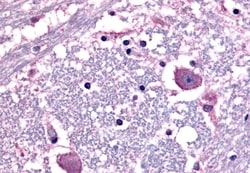 Invitrogen CRHR1 Polyclonal Antibody 50 μg; Unconjugated:Antibodies,