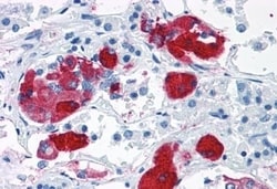 Invitrogen CRHR2 Polyclonal Antibody 50 &mu;g; Unconjugated:Antibodies,