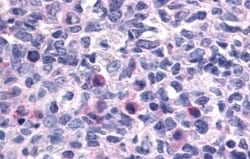 Invitrogen CXCR1 Polyclonal Antibody 50 &mu;g; Unconjugated:Antibodies,