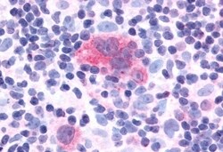 Invitrogen CXCR1 Polyclonal Antibody 50 &mu;g; Unconjugated:Antibodies,