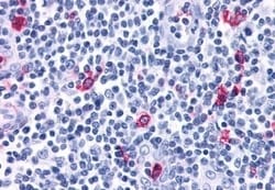 Invitrogen CXCR3 Polyclonal Antibody 50 &mu;g; Unconjugated:Antibodies,