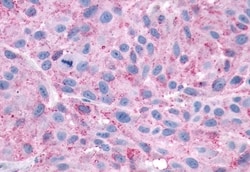 Invitrogen CXCR3 Polyclonal Antibody 50 &mu;g; Unconjugated:Antibodies,