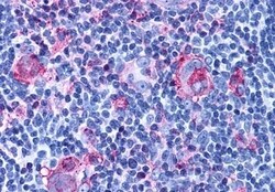 Invitrogen CXCR3 Polyclonal Antibody 50 &mu;g; Unconjugated:Antibodies,