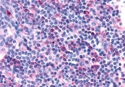 Invitrogen CXCR3 Polyclonal Antibody 50 &mu;g; Unconjugated:Antibodies,