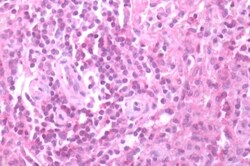Invitrogen CXCR3 Polyclonal Antibody 50 &mu;g; Unconjugated:Antibodies,