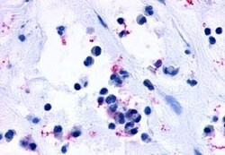 Invitrogen CYSLTR1 Polyclonal Antibody 50 &mu;g; Unconjugated:Antibodies,