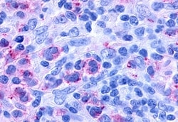 Invitrogen CYSLTR1 Polyclonal Antibody 50 &mu;g; Unconjugated:Antibodies,