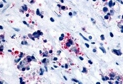 Invitrogen CYSLTR1 Polyclonal Antibody 50 &mu;g; Unconjugated:Antibodies,