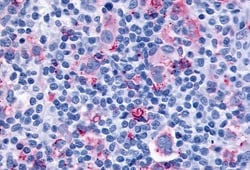 Invitrogen CYSLTR1 Polyclonal Antibody 50 &mu;g; Unconjugated:Antibodies,