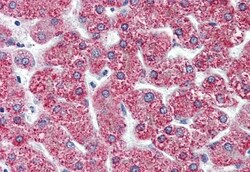 Invitrogen CYSLTR2 Polyclonal Antibody 50 &mu;g; Unconjugated:Antibodies,