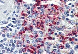 Invitrogen CYSLTR2 Polyclonal Antibody 50 &mu;g; Unconjugated:Antibodies,