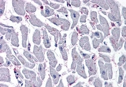 Invitrogen CYSLTR2 Polyclonal Antibody 50 &mu;g; Unconjugated:Antibodies,
