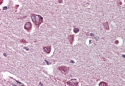 Invitrogen DPP10 Polyclonal Antibody 50 &mu;g; Unconjugated:Antibodies,