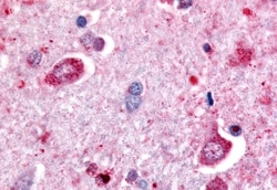 Invitrogen DPP6 Polyclonal Antibody 50 &mu;g; Unconjugated:Antibodies,