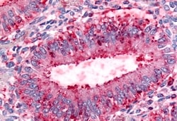 Invitrogen DPP8 Polyclonal Antibody 50 &mu;g; Unconjugated:Antibodies,
