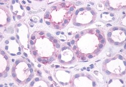 Invitrogen DRD1 Polyclonal Antibody 50 μg; Unconjugated:Antibodies,