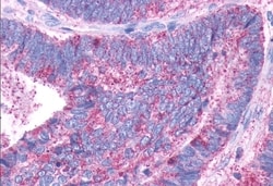 Invitrogen DRD1 Polyclonal Antibody 50 μg; Unconjugated:Antibodies,