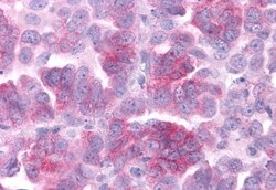 Invitrogen DUSP23 Polyclonal Antibody 50 &mu;g; Unconjugated:Antibodies,