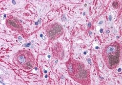 Invitrogen DUSP23 Polyclonal Antibody 50 &mu;g; Unconjugated:Antibodies,