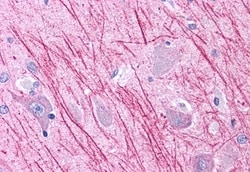 Invitrogen DUSP23 Polyclonal Antibody 50 &mu;g; Unconjugated:Antibodies,