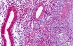 Invitrogen DUSP23 Polyclonal Antibody 50 &mu;g; Unconjugated:Antibodies,