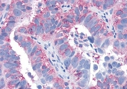 EDG3 Polyclonal Antibody:Antibodies, Polyclonal
